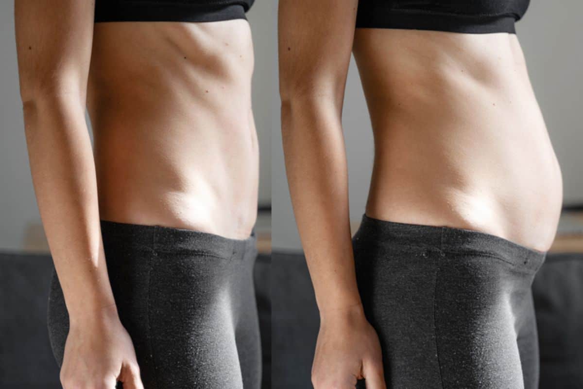 How long does diastasis recti take to improve Leominster?