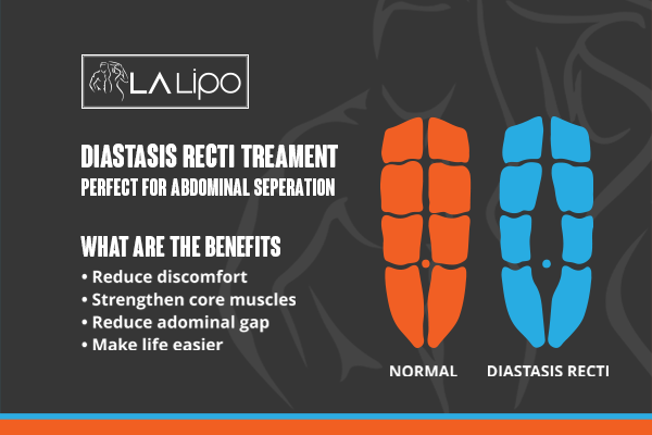 When Should You Consider Professional Help for Core Recovery Leominster