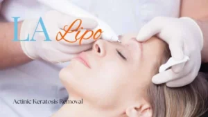 Woman receiving Actinic Keratosis Removal Treatment Leominster
