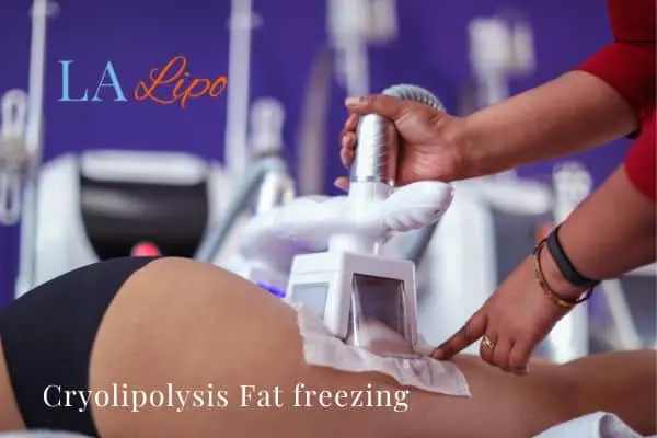 women getting fat freezing Leominster