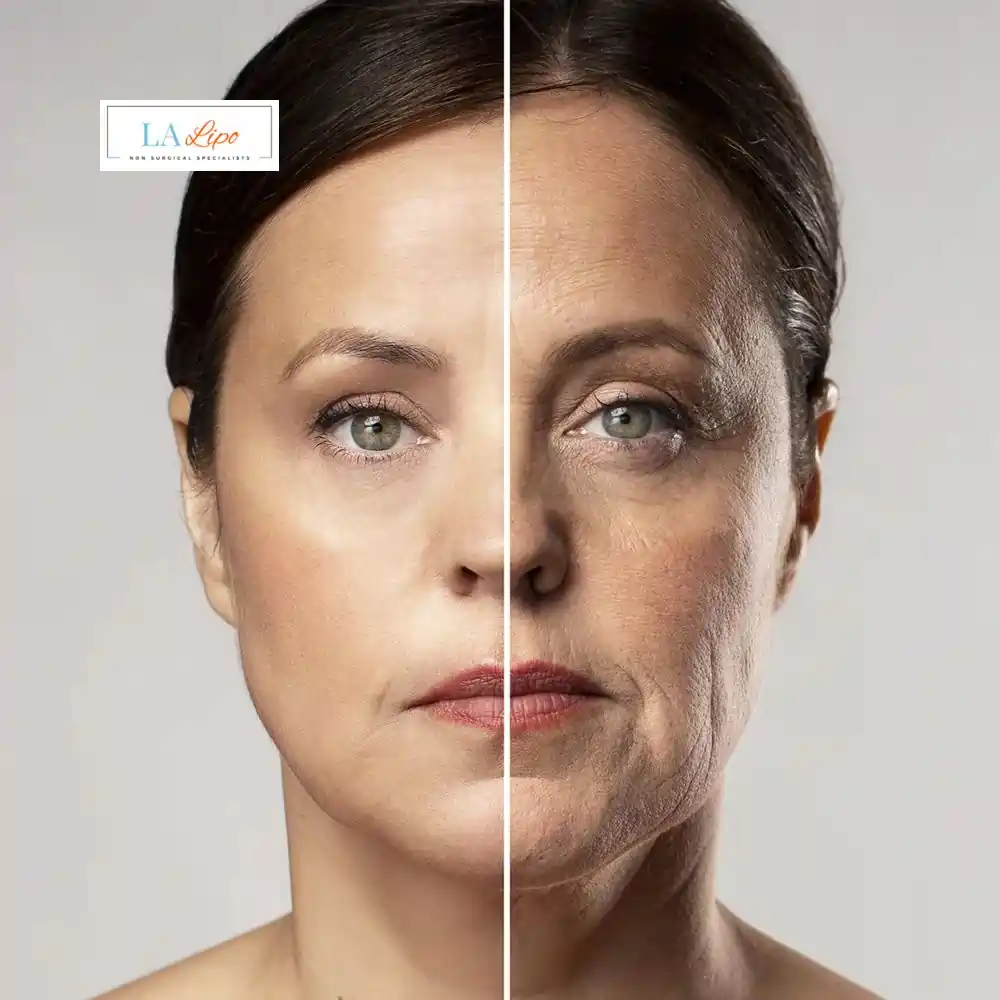 How Can You Tell If Non-Surgical Skin Tightening Is Right for You Leominster?