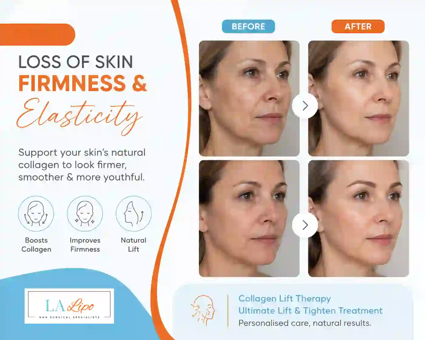 Sign #7: Loss of Skin Firmness and Elasticity Leominster