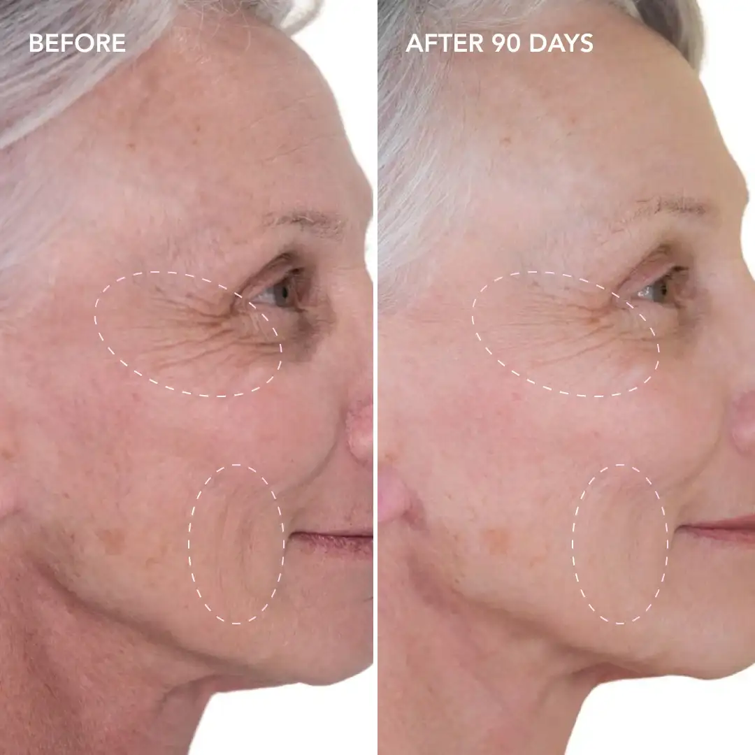 When will you see results Leominster